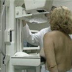 Identifican gen de resistencia al tratamiento de cáncer de mama
